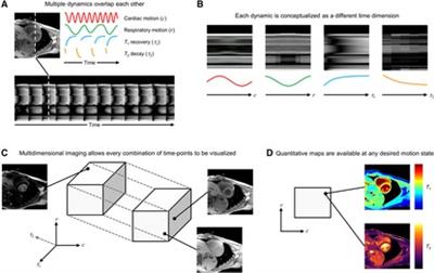 Editorial: Simultaneous multiparametric and multidimensional cardiovascular magnetic resonance imaging